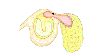 cholosteatoma