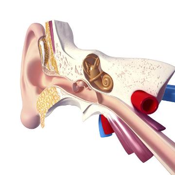 Otosclerosis